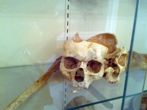 Human bones on display in the Old Chapel on Castleton State College campus. (Joanna Tebbs Young / photo)